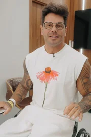 Fernando Fernandes passou por transplante capilar.