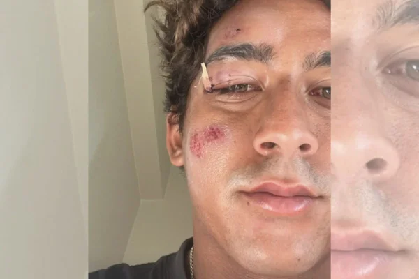 Imagem colorida de Samuel Pupo, brasileiro que sofreu acidente na WSL- Metrópoles