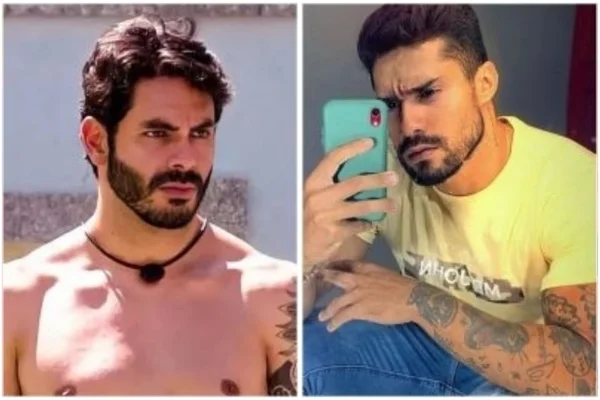 Harmonização Facial: veja a mudança dos participantes do BBB21