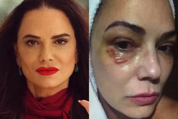 Luiza Brunet desabafa após ex ser condenado por agressões: “Muito pouco”
