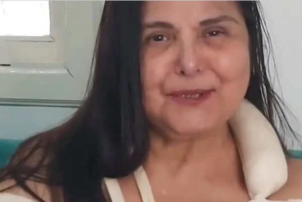 Elizangela explica como quebrou dois braços em acidente doméstico