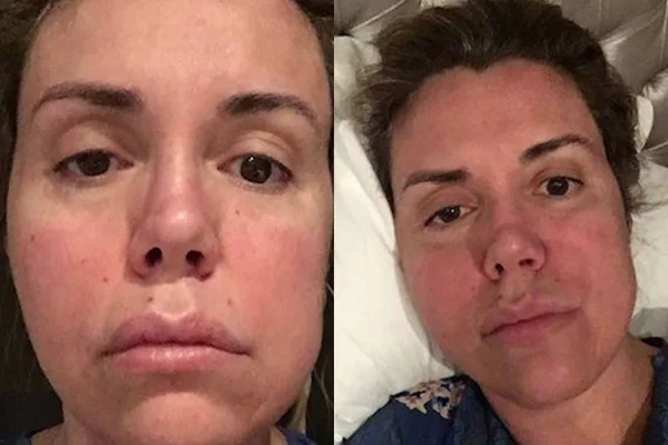 Renata Banhara relembra bactéria no cérebro e diz: “Acreditar sempre”