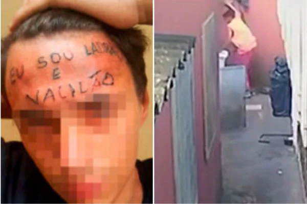 Imagem colorida mostra jovem que teve frase "ladrão e vacilão" tatuada na testa. Metrópoles