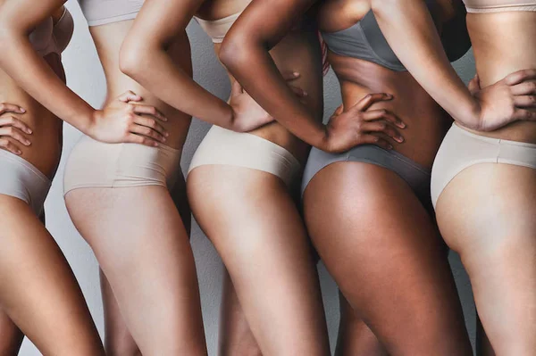mulheres com estrias e celulites à mostra