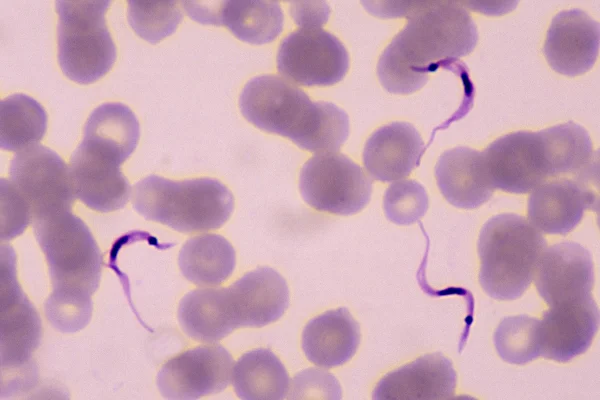 Imagem mostra o protozoário Trypanosoma cruzi, que causa a doença de Chagas - Metrópoles
