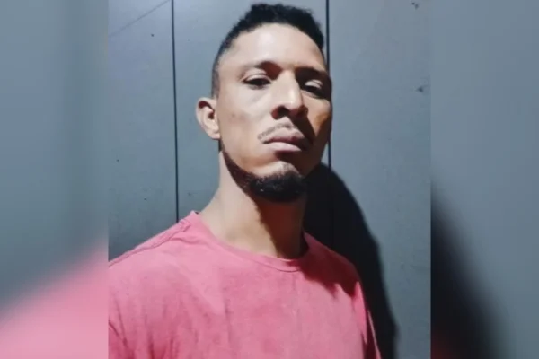 Mulher denuncia ex após ter maxilar quebrado e ficar com rosto deformado - destaque galeria Mulher denuncia ex após ter maxilar quebrado e ficar com rosto deformado - destaque galeria