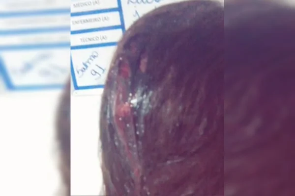 "Vou te matar": sangrando, mulher foge de ataque agressor que a ameaça