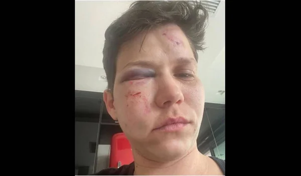 Bolsonaro rechaça violência contra Karol Eller, diz porta-voz