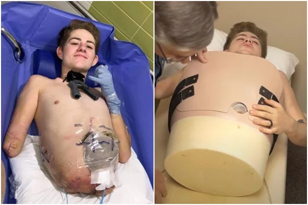 jovem com metade do corpo
