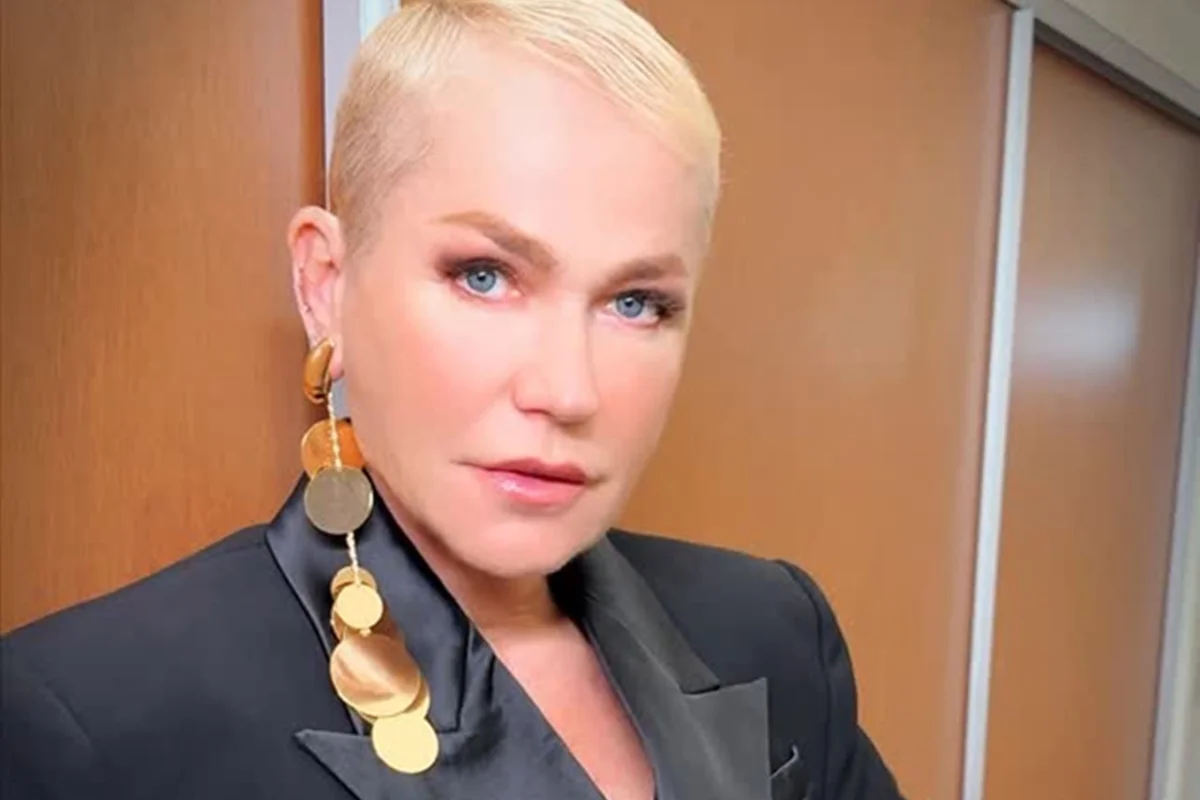 Fãs lembram rinoplastia de Xuxa com médico cubano que acabou preso