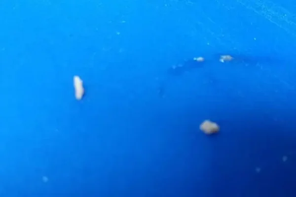 Imagem colorida mostra larvas encontradas por alunos em comida servida em escola - Metrópoles