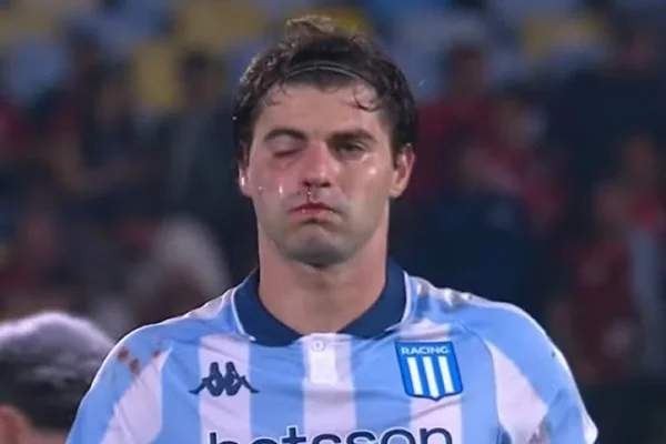 Titular do Racing passa por cirurgia e perde jogo contra o Flamengo
