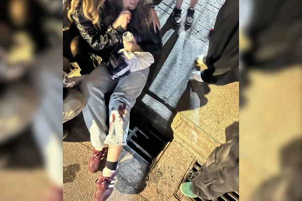 Segundo o relato da internauta, ela não conseguia ver o chão ao tentar sair do show de Harry Styles em SP e pisou em um bueiro quebrado - Metrópoles