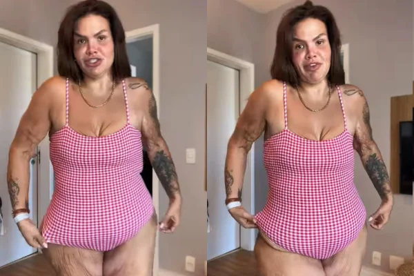 Thais Carla sobre excesso de pele após perder 120 kg: “Não deixo de viver”