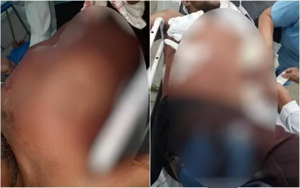 imagem colorida homem esfaqueado apos passar mao nas nadegas de mulher em bar goias