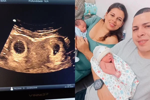 Em caso raro, Paloma Matos gerou os gêmeos em úteros separados. Hoje em dia mãe de três, ela acreditava que nunca poderia ter filhos - Metrópoles