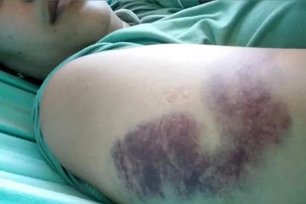Fisioterapeuta agredida por motorista de app após pedir parada