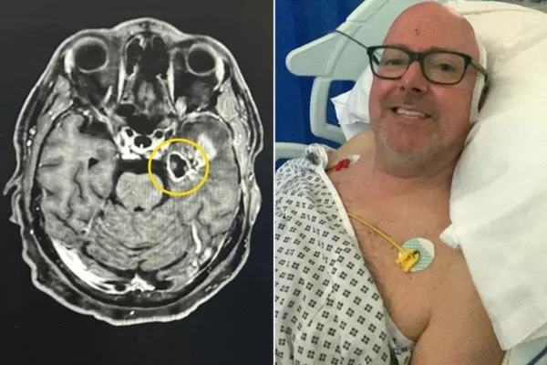Exame de imagem do cérebro de Simon Hollister, Simon Hollister no hospital- Metrópoles