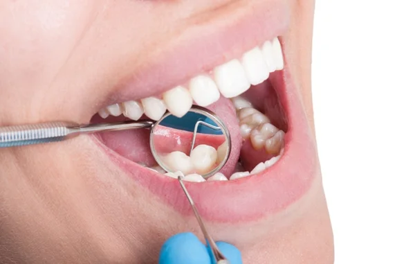 A limpeza dos seus dentes está em dia?