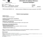 relatório anatomopatológico diagnostica o tipo e o grau do tumor 
