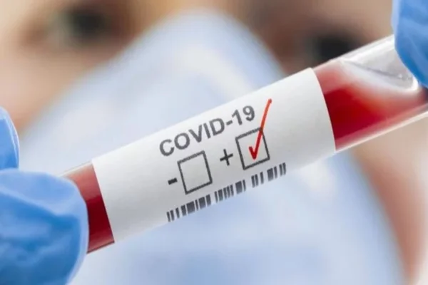 DF: pelo 3º dia consecutivo, taxa de transmissão da Covid fica em 1,01