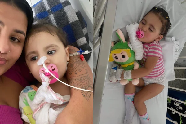 Sophia levou um choque em uma tomada em dezembro de 2024. Sua mãe, Shirley, abriu uma vaquinha virtual para bancar o tratamento da filha - Metrópoles