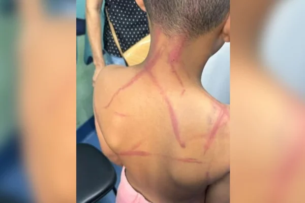 Criança de 9 anos é torturada por casal, no Rio de Janeiro