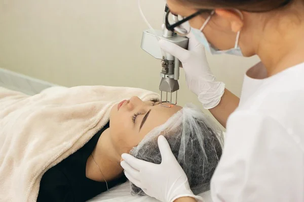 Peeling de fenol