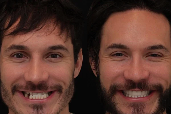Foto colorida de um homem sorrindo - Metrópoles