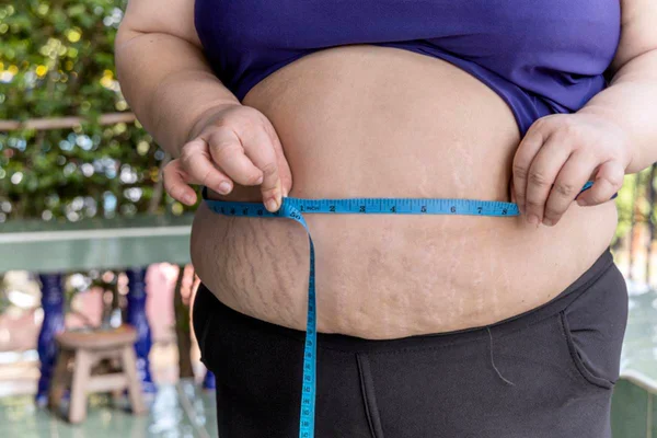 Pesquisa da USP encontra hormônio capaz de reverter danos da obesidade