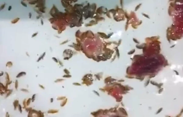 Jovem é internado após ser atacado por parasita carnívoro em mar
