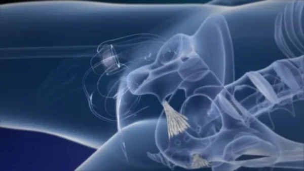 Vídeo mostra em detalhes o funcionamento da cirurgia de mudança de sexo
