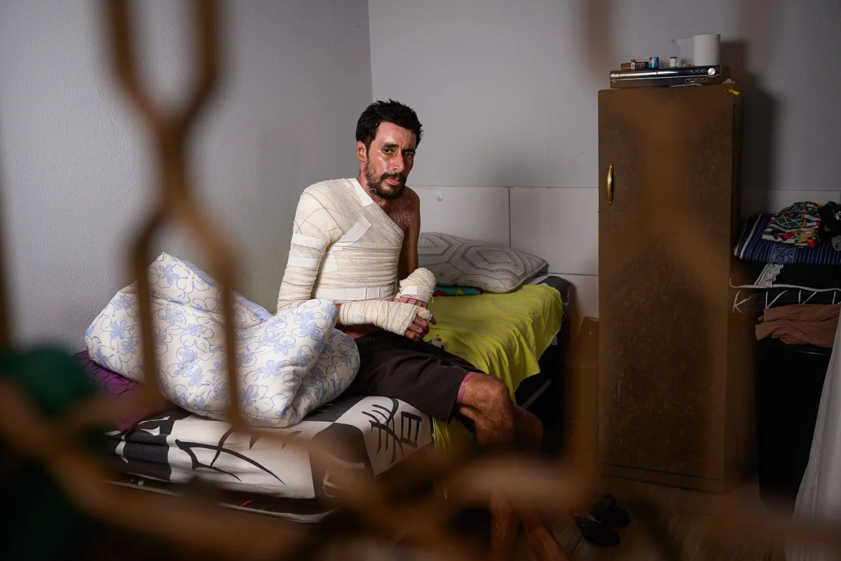 Braços, mãos e axilas de Gustavo permanecem cobertos por faixas durante a recuperação. As queimaduras também afetaram a força das mãos Braços, mãos e axilas de Gustavo permanecem cobertos por faixas durante a recuperação. As queimaduras também afetaram a força das mãos