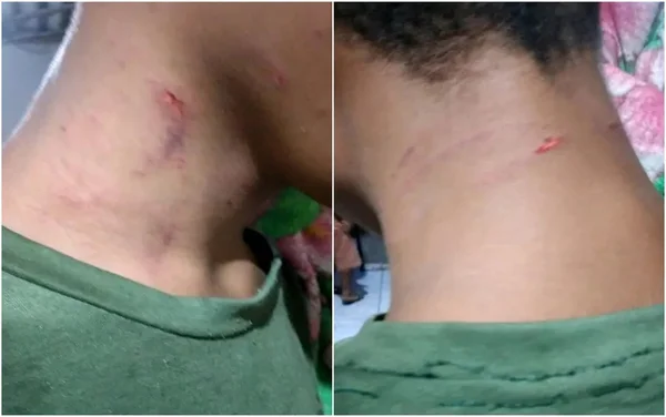 goias adolescente agredido pela mãe