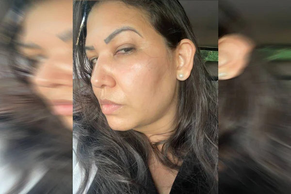 Por falta de médico, servidora apanha de paciente em UBS da Ceilândia