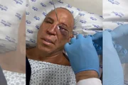 Wanderlei teve que ser levado ao hospital
