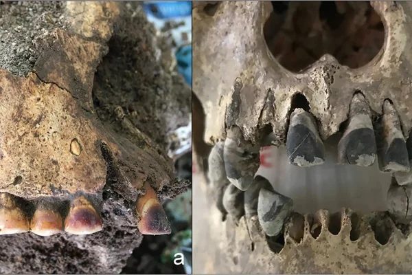 Imagem colorida mostra esqueletos com dentes pretos - Metrópoles