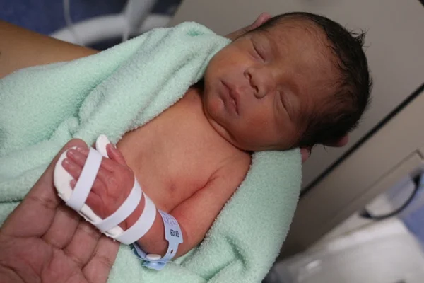 bebê prematuro com órtese de baixo custo