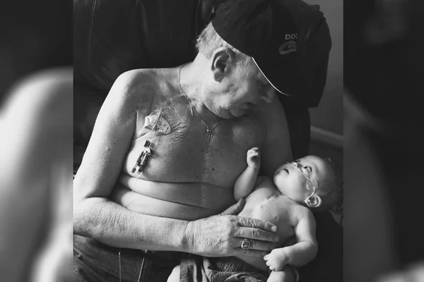 Foto de avô e neto bebê com cicatriz no peito comove internet