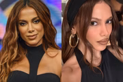 Veja antes e depois de Anitta após infecção bacteriana grave; fotos Veja antes e depois de Anitta após infecção bacteriana grave; fotos