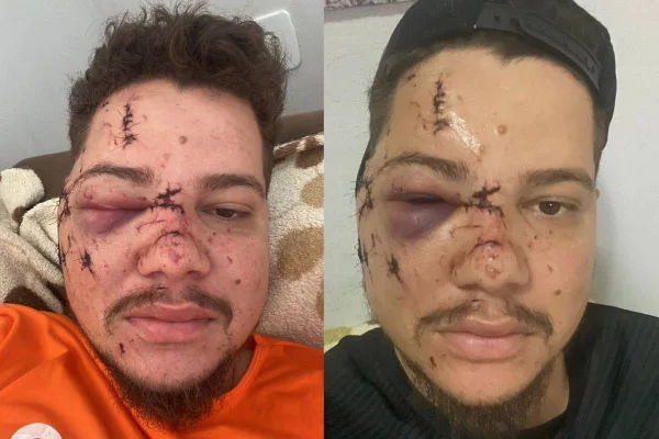 montagem com fotos de rosto de homem costurado em varias partes - metrópoles