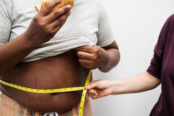 Foto colorida de corpo masculino segurando um hamburguer enquanto outra pessoa mede com fita métrica a circuferência do abdomen - Metrópoles