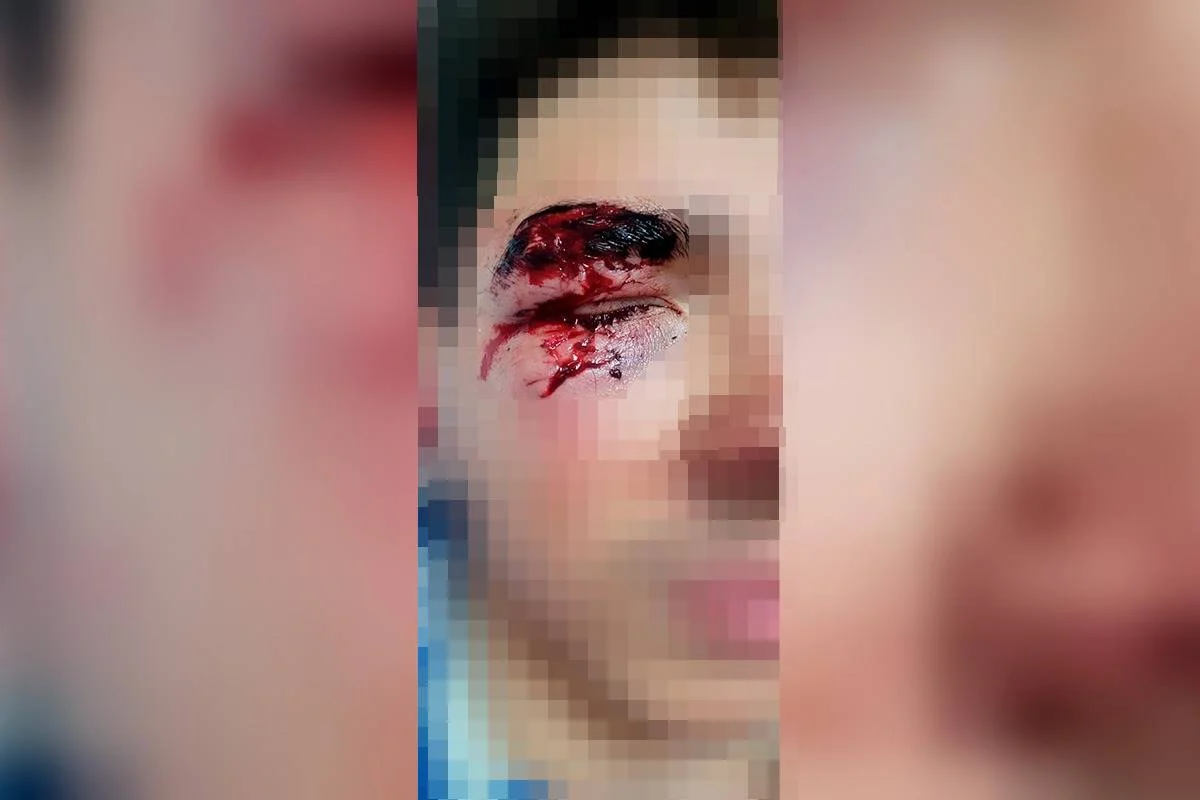 Onda de ataques por pessoas em situação de rua preocupa o DF