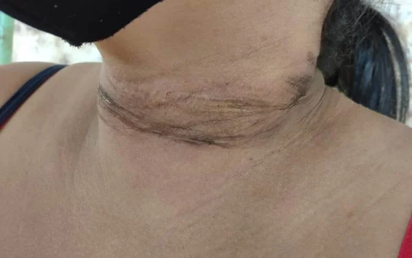 goias mulher pescoço ferido fio de internet