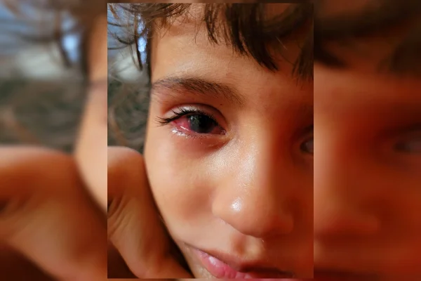 Menina de 6 anos corre contra o tempo para não perder a visão