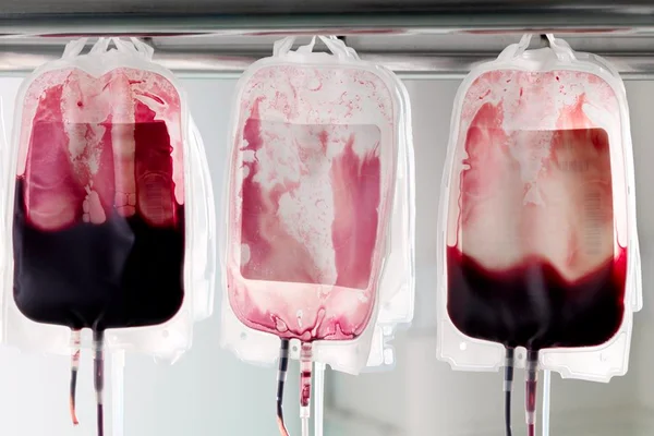 Especialista tira dúvidas sobre doação de sangue em tempos de pandemia