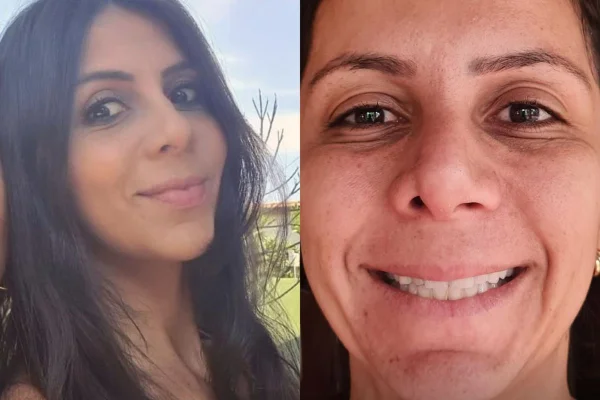 Foto de Marina Figueiredo, que passou por uma rinoplastia clandestina com dentista. Metrópoles