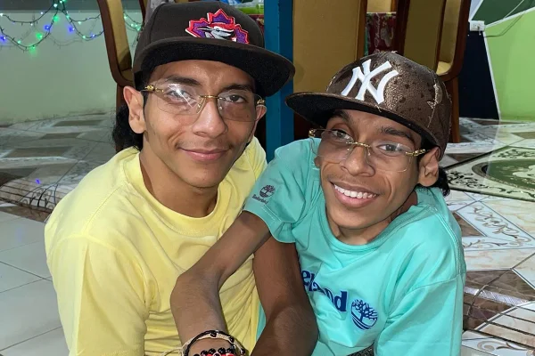 Gêmeos siameses do Equador morrem aos 27 anos na Colômbia - destaque galeria Gêmeos siameses do Equador morrem aos 27 anos na Colômbia - destaque galeria