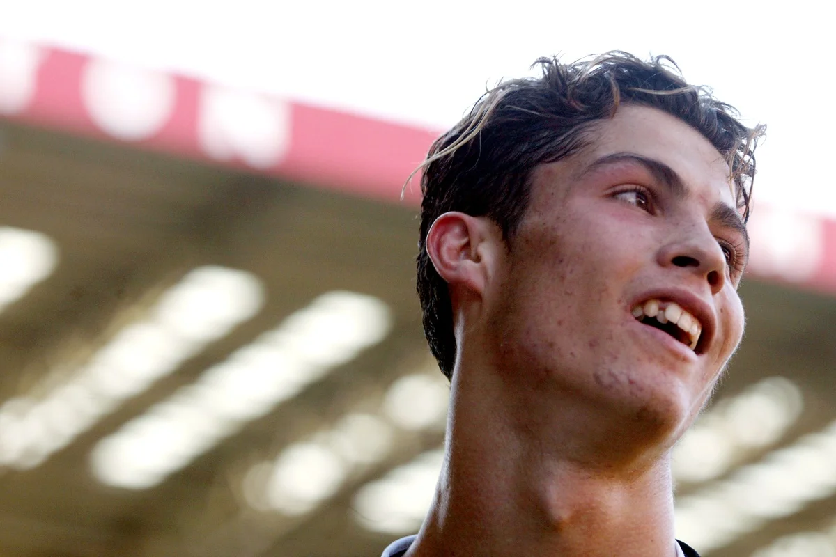 Antes e depois de Cristiano Ronaldo Antes e depois de Cristiano Ronaldo