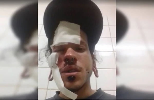 Vídeo. PCDF procura agressores de professor de inglês